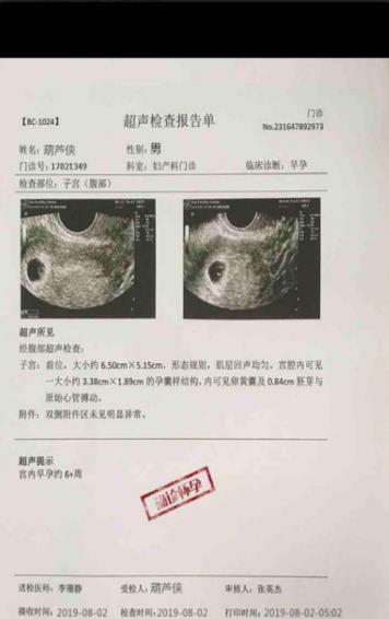 B超怀孕恶搞通知生成