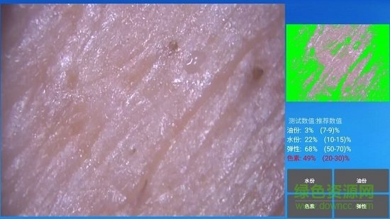 mrkv智能头皮皮肤检测