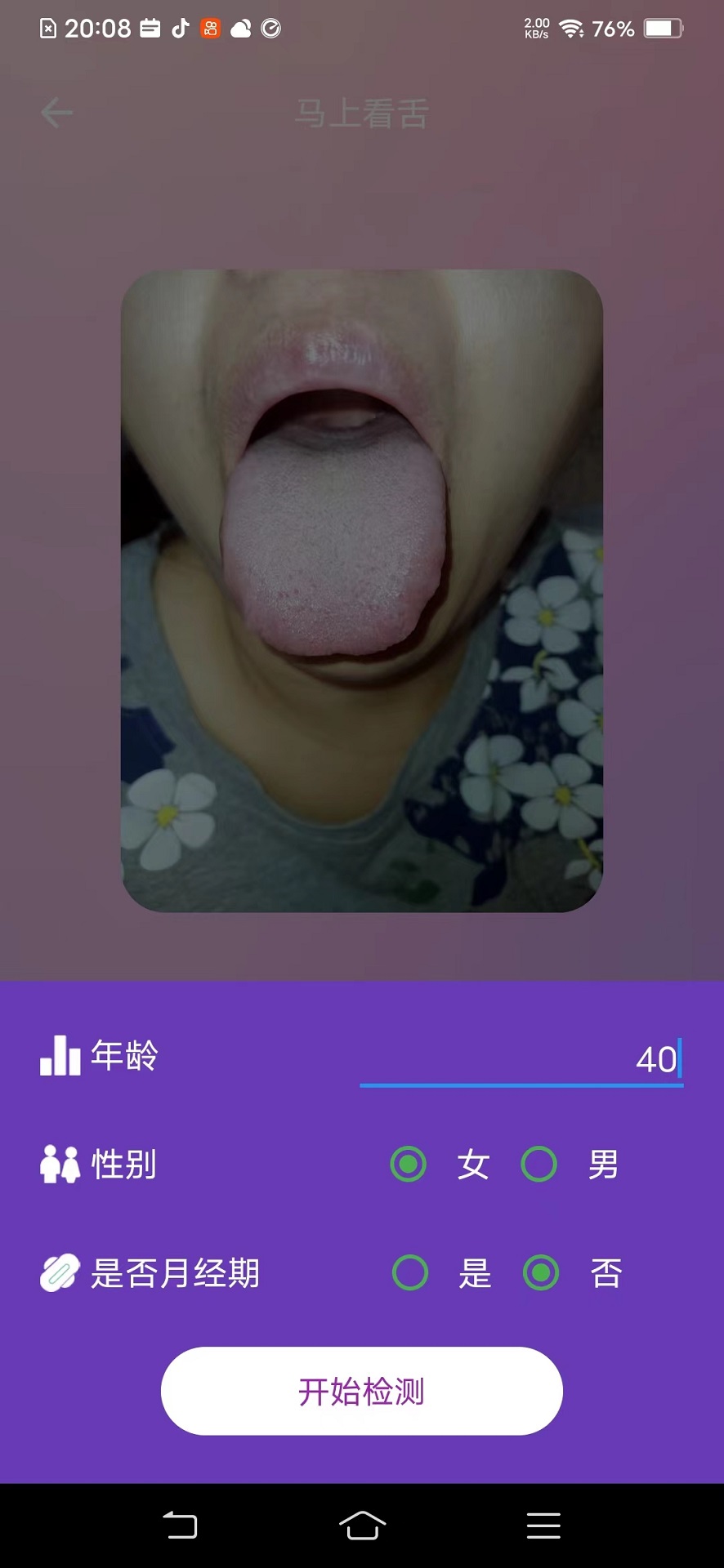 AI看舌